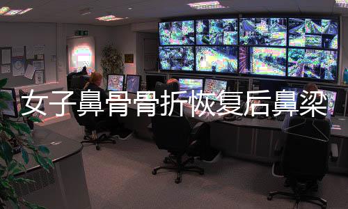 女子鼻骨骨折恢復(fù)后鼻梁提升，重拾自信美麗